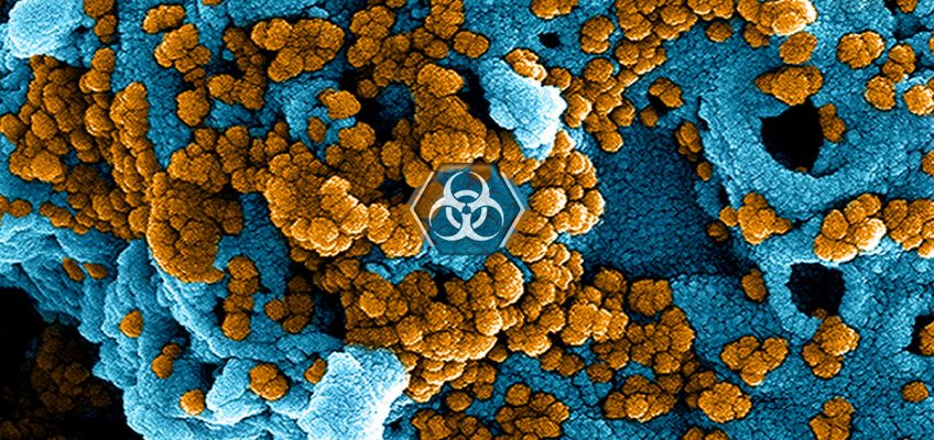 Virus Pandemic